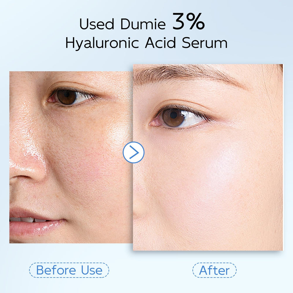 Dumie serum application on cheek demonstrates quick absorption and hydration