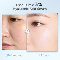 Dumie serum application on cheek demonstrates quick absorption and hydration