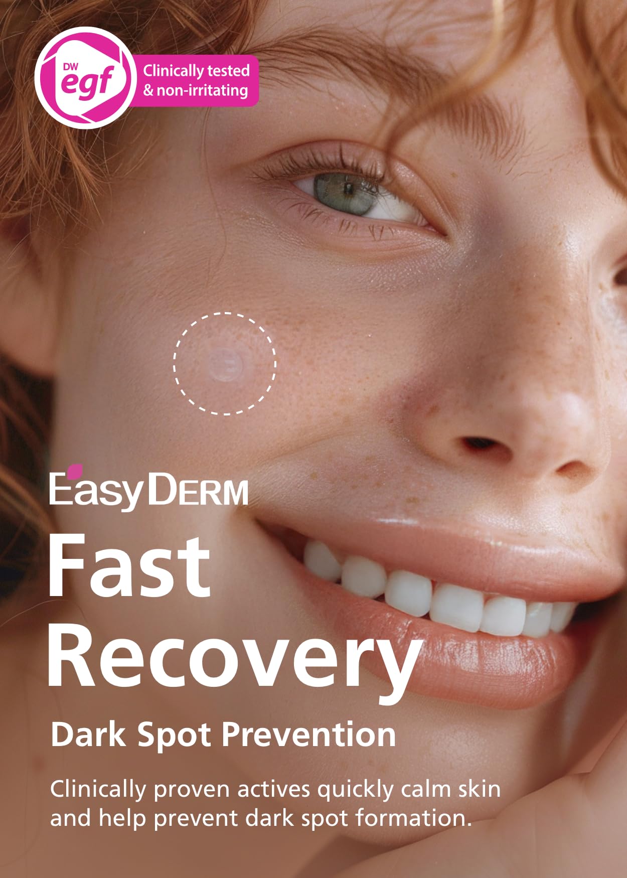 DWEasyDerm Easyderm patch microdart core targets deep blemishes
