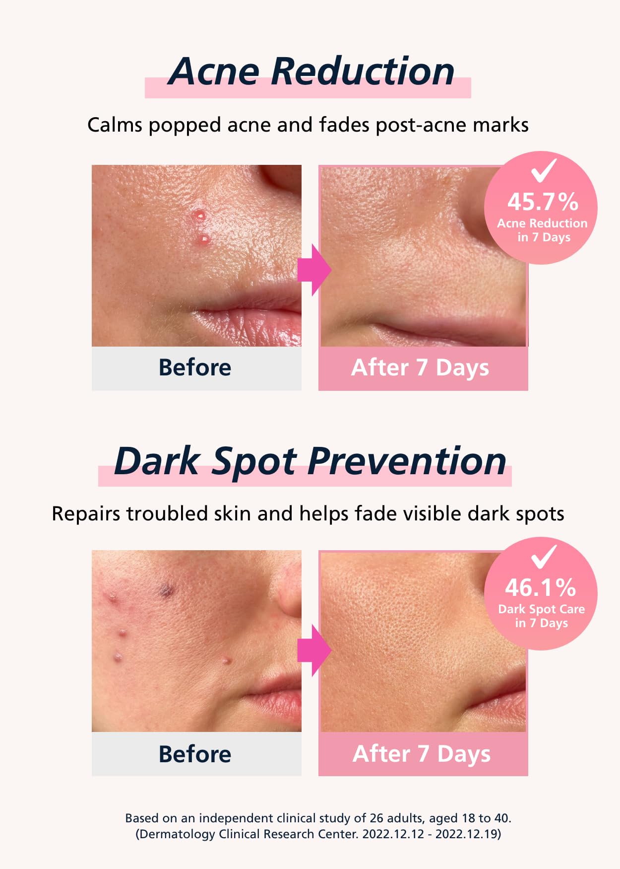 DWEasyDerm Easyderm patch invisible under makeup