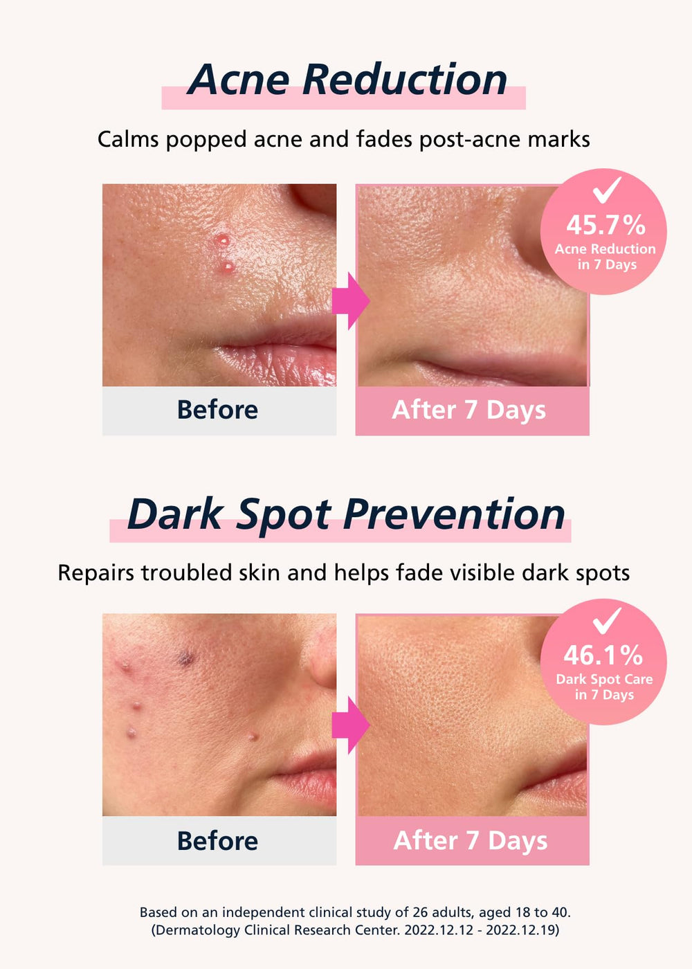 DWEasyDerm Easyderm patch invisible under makeup