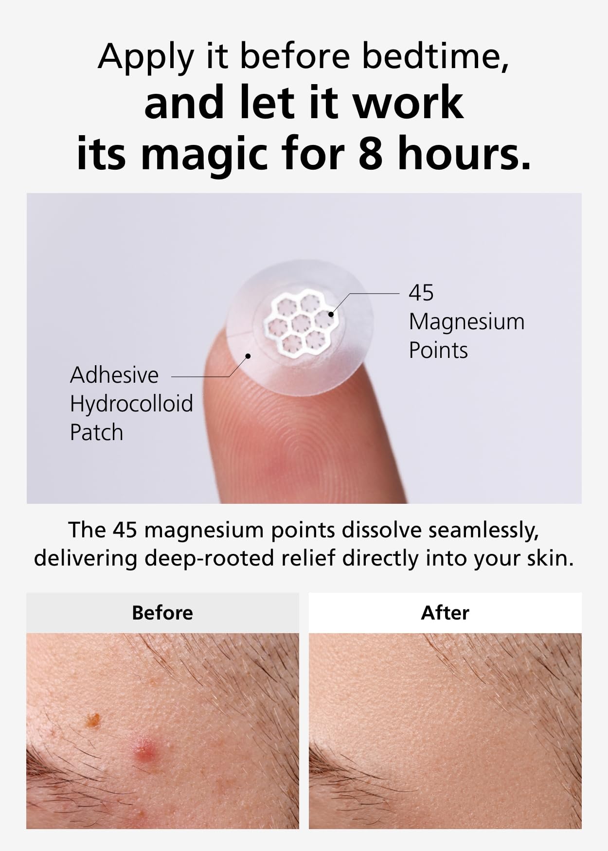 DWEasyDerm tea tree ampoule bottle used before patch application for calming prep.