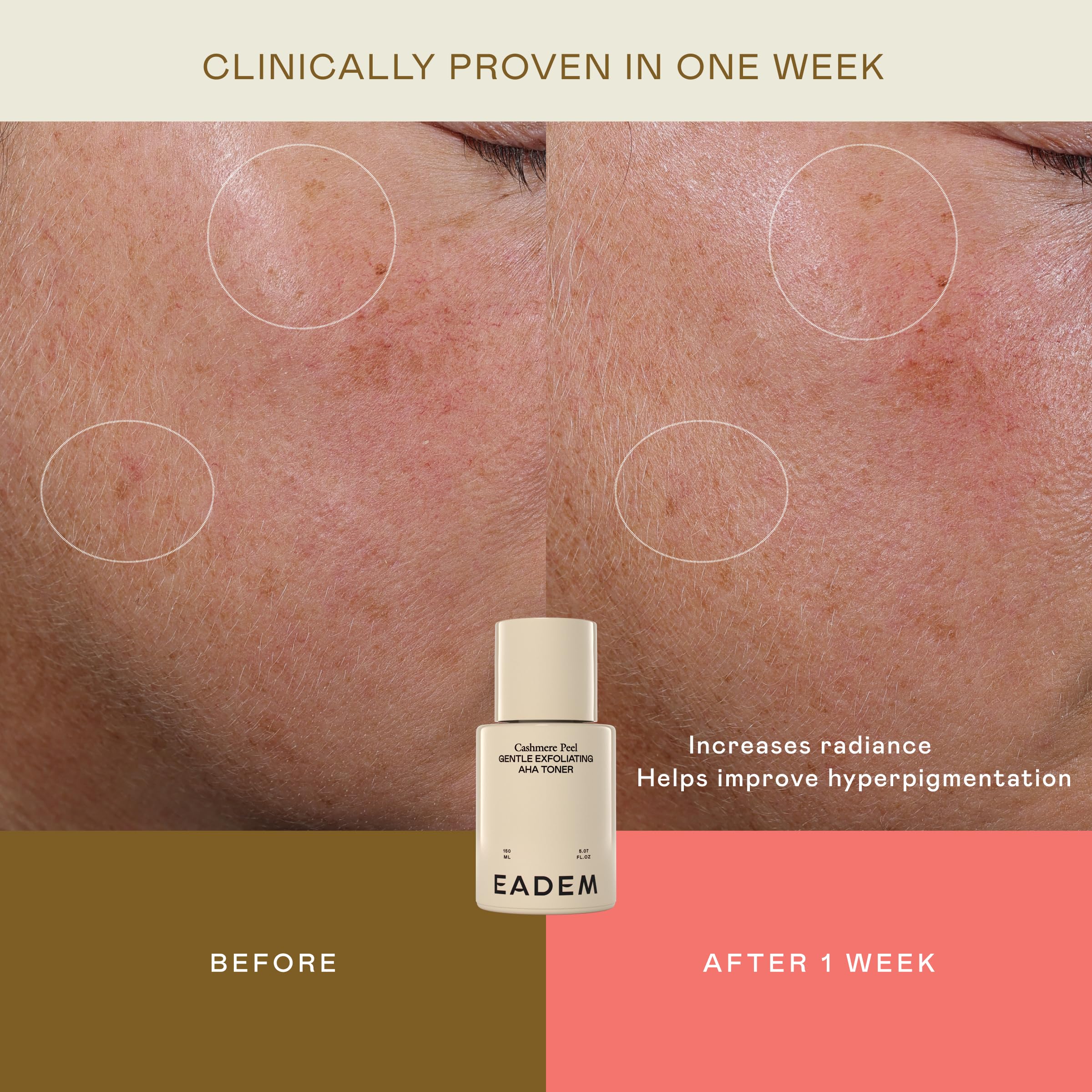 EADEM Cashmere Peel ingredient highlight featuring azelaic, lactic, and tranexamic acids
