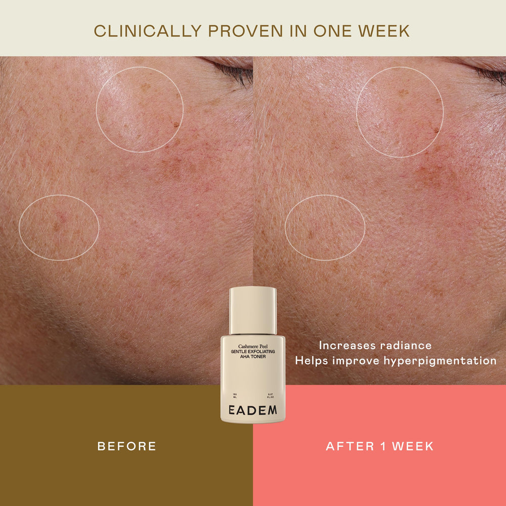EADEM Cashmere Peel ingredient highlight featuring azelaic, lactic, and tranexamic acids
