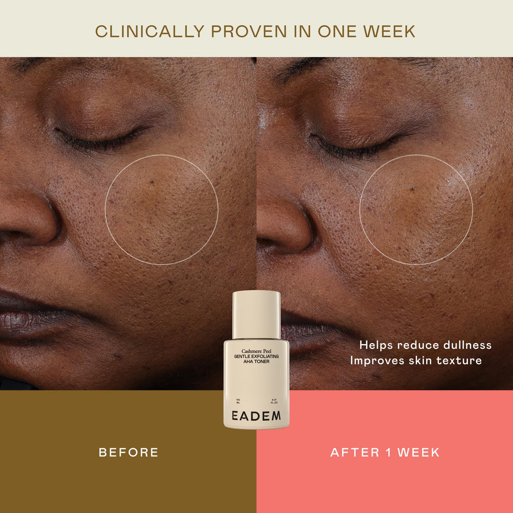 EADEM Cashmere Peel skin glow shot emphasizing radiance and texture renewal
