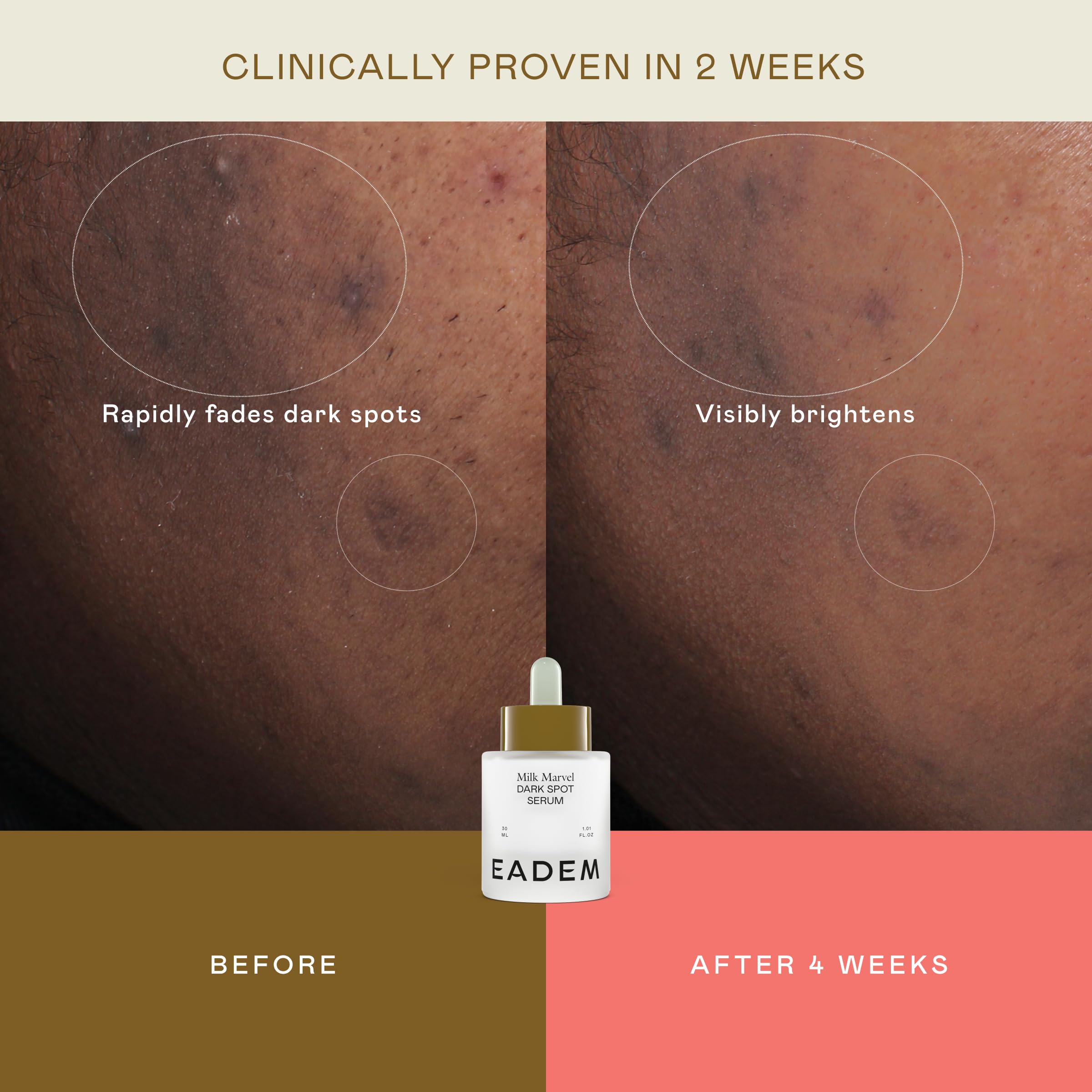EADEM Milk Marvel serum texture on skin suggests balanced tone.