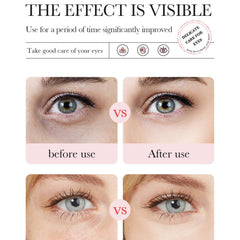 Eakroo Rose Eye Masks hydrogel texture delivers gentle hydration and comfortable wear.