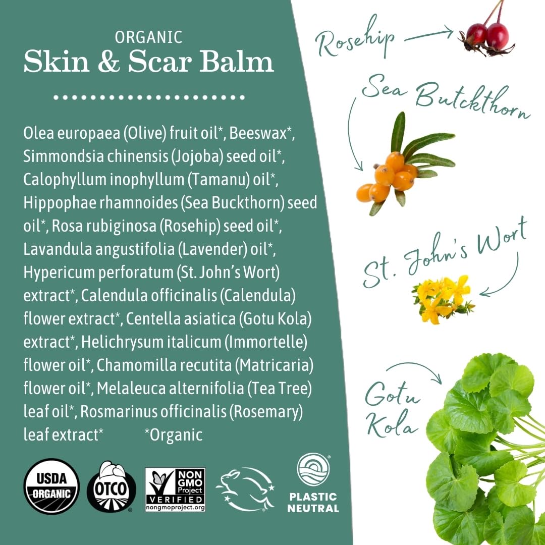 Earth Mama Organic Skin & Scar Balm calendula infusion on lid signaling calming care.