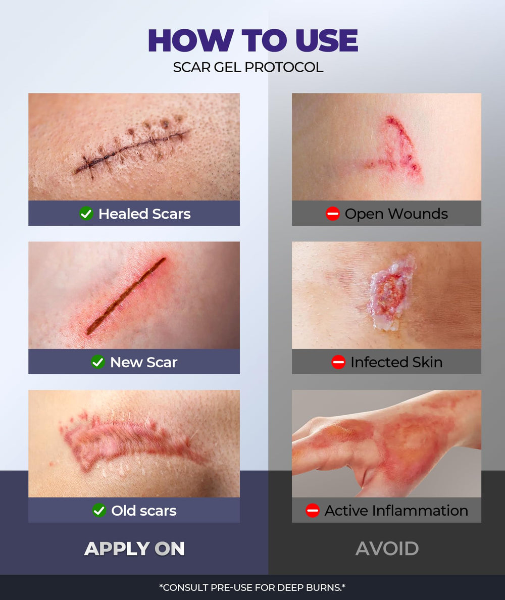 EASEWAVE 55ml bottle detail highlights compact tube for ongoing scar care