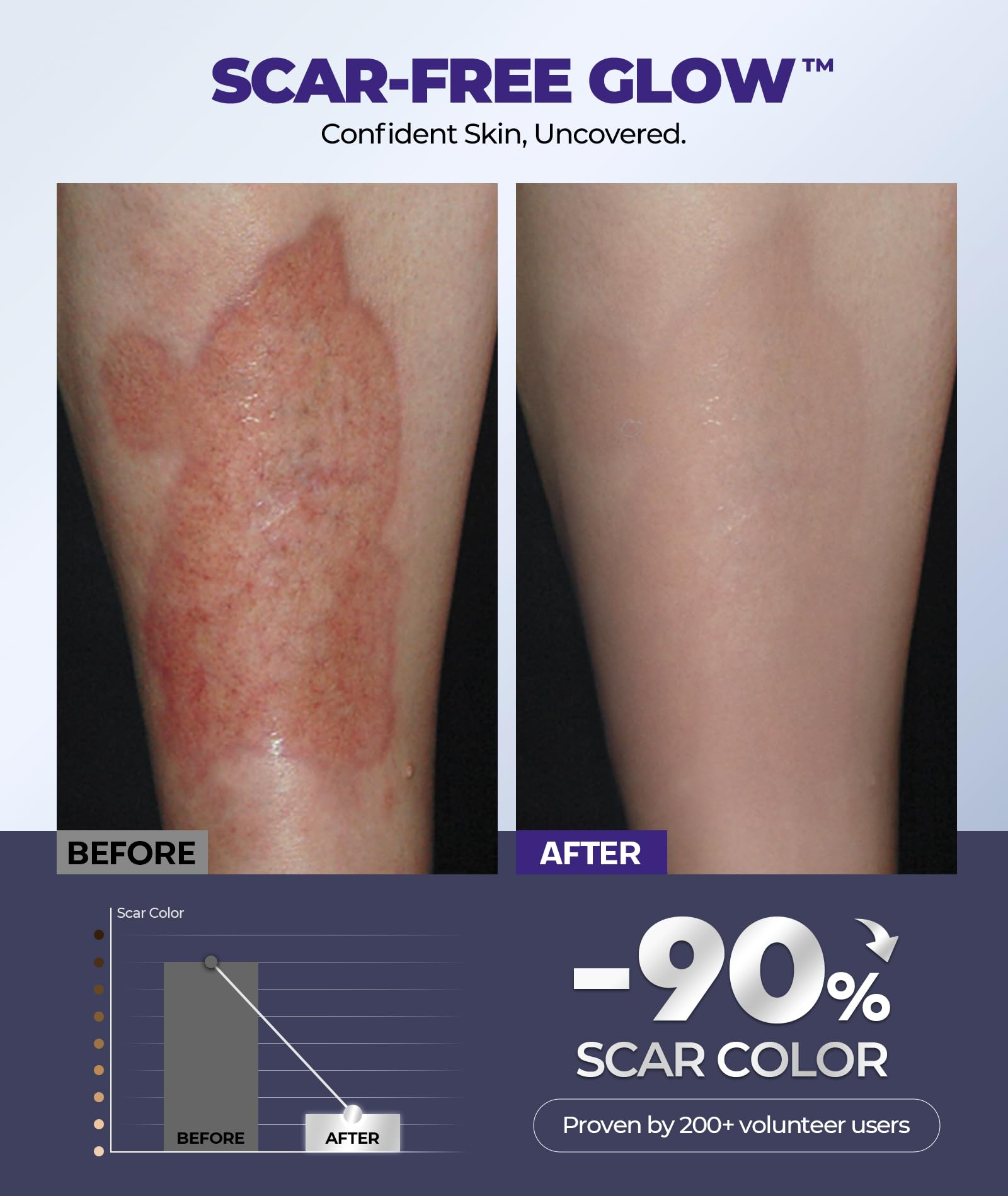 EASEWAVE silicone-gel formulation close-up shows 6.7% active blend for scar improvement