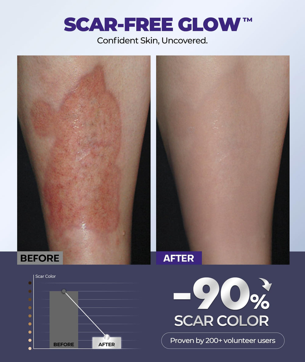 EASEWAVE silicone-gel formulation close-up shows 6.7% active blend for scar improvement