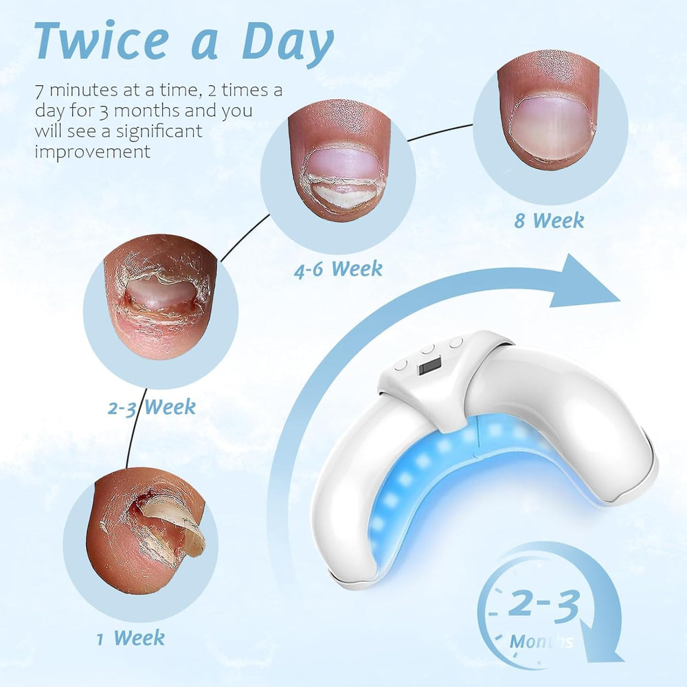 Easheal Nail Fungus LED light device automatic-sensing enables hands-free operation.