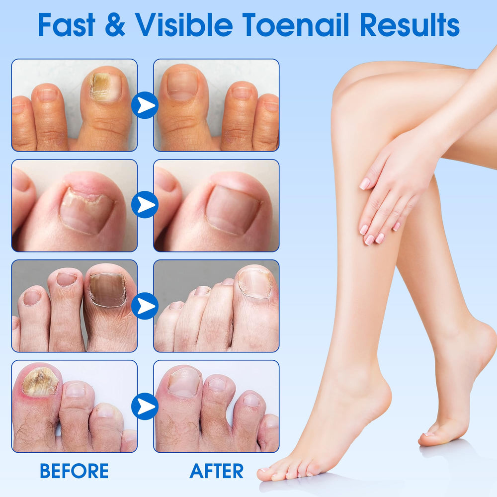 Nails with EASICUTI patches showing easy no-mess application