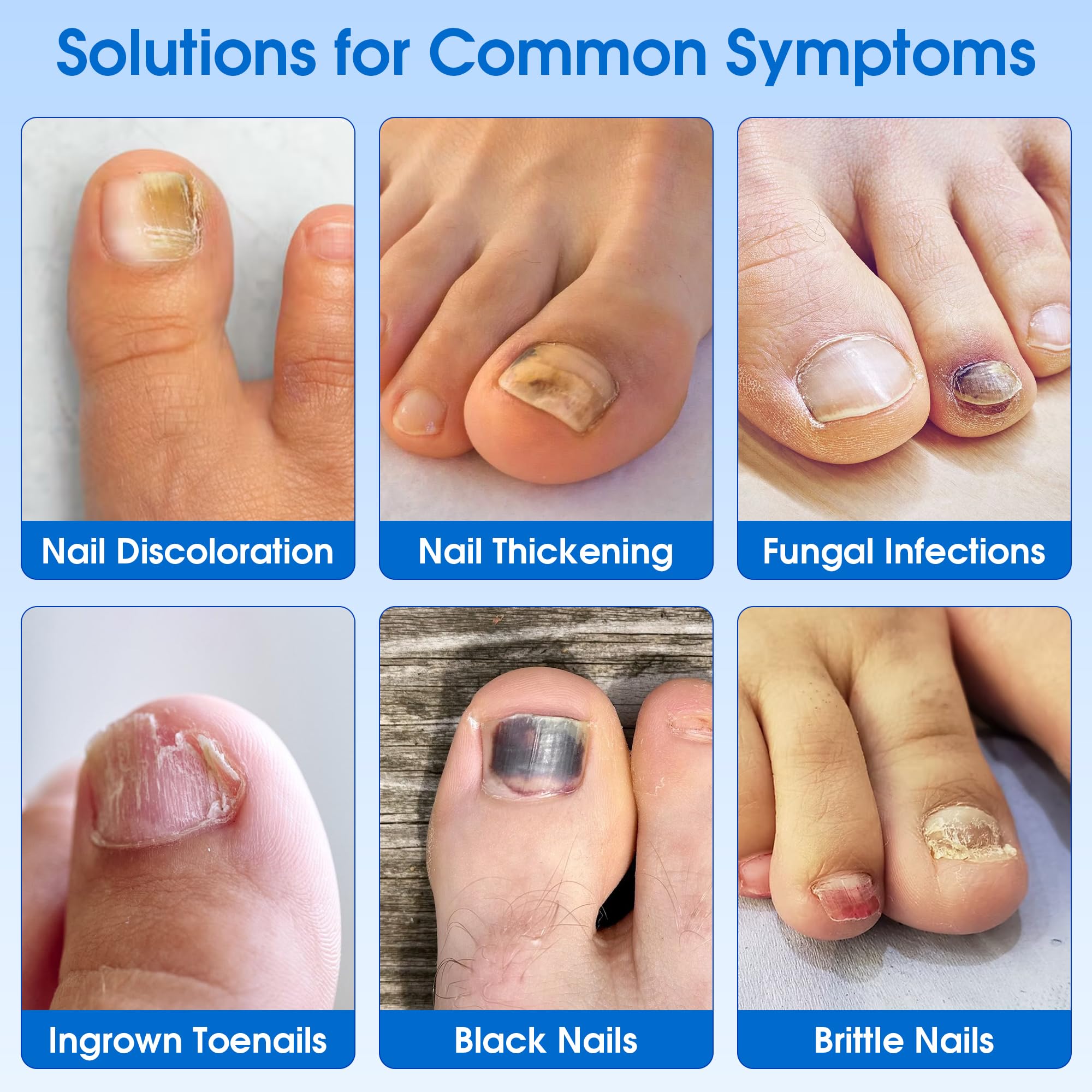 Close-up of an EASICUTI patch applied on a nail for discreet care