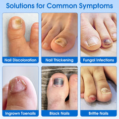 Close-up of an EASICUTI patch applied on a nail for discreet care
