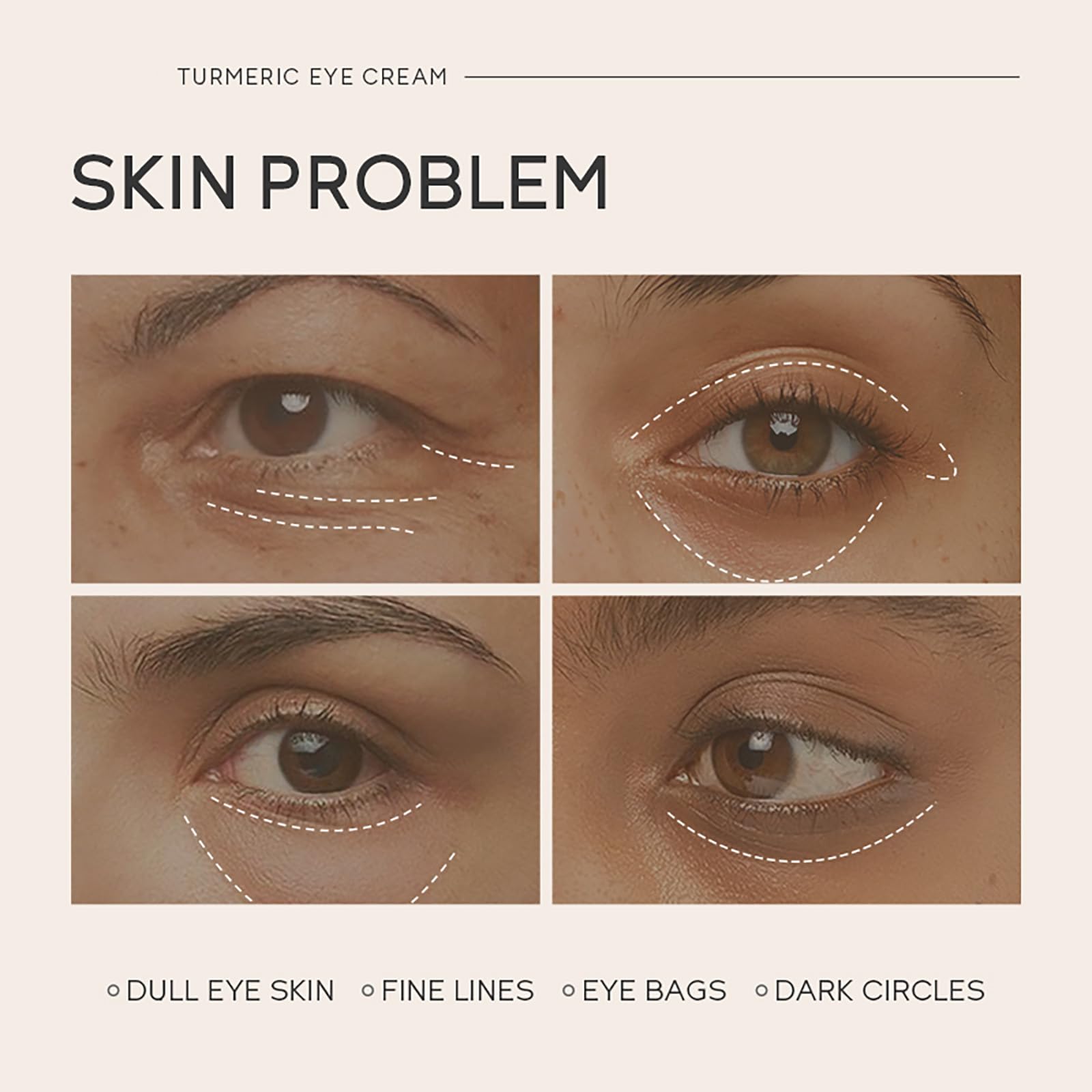 Easilydays Turmeric Under Eye Cream after use shows refreshed, hydrated eye area.