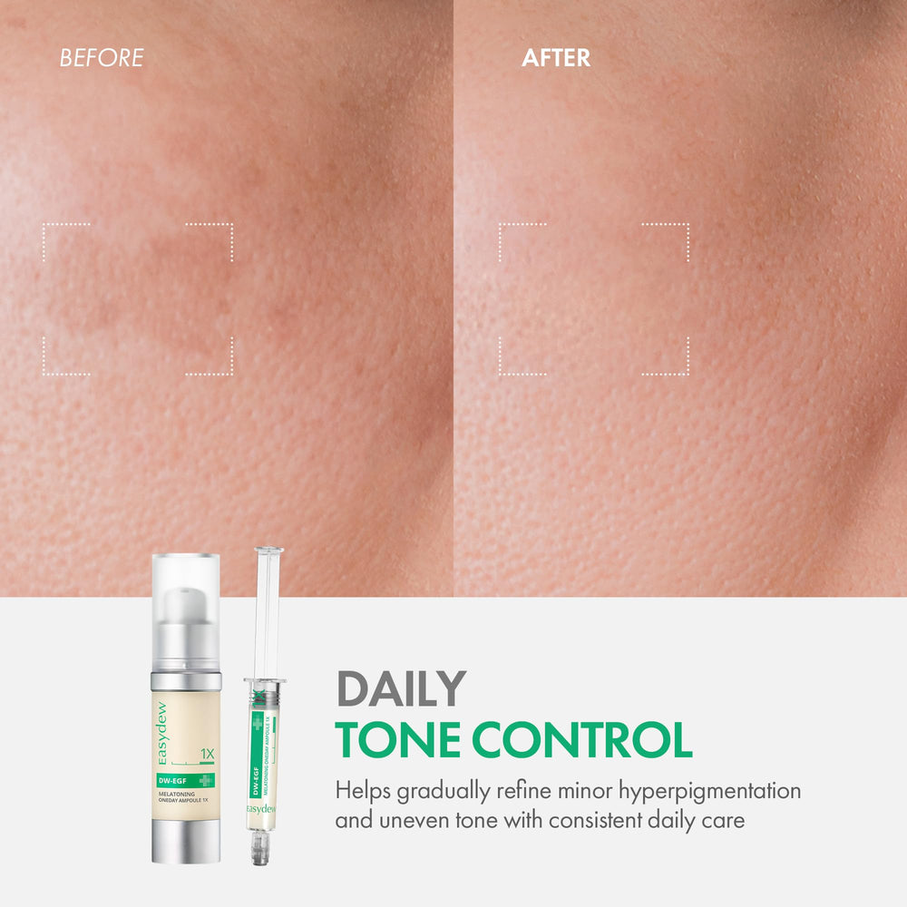 Easydew DW-EGF Melatoning Ampoule ingredients-glutathione-niacinamide supporting brightness and tone