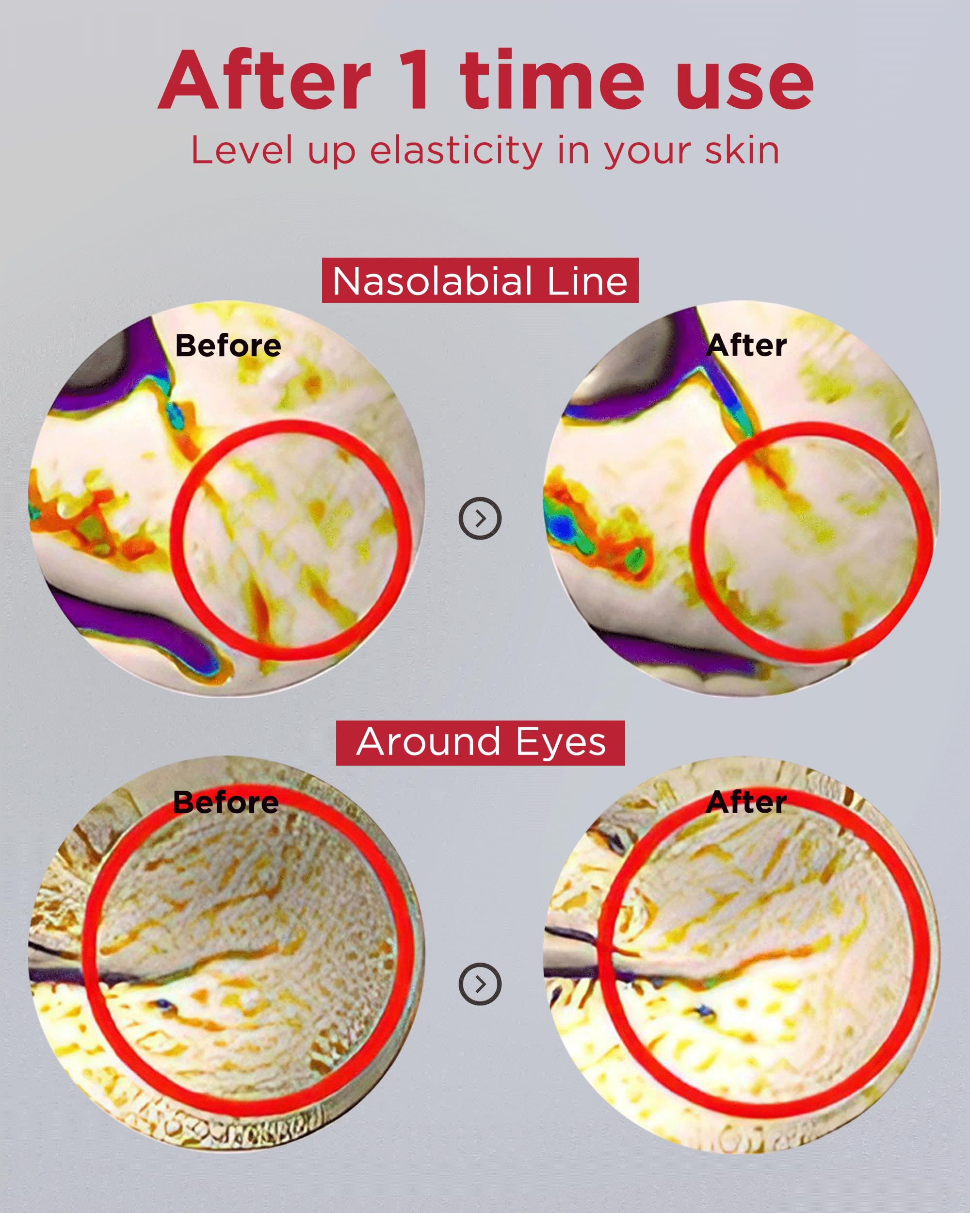 EASYDEW DW-EGF Pressome Cream ingredients visual—ceramide and hyaluronic acid for barrier support.