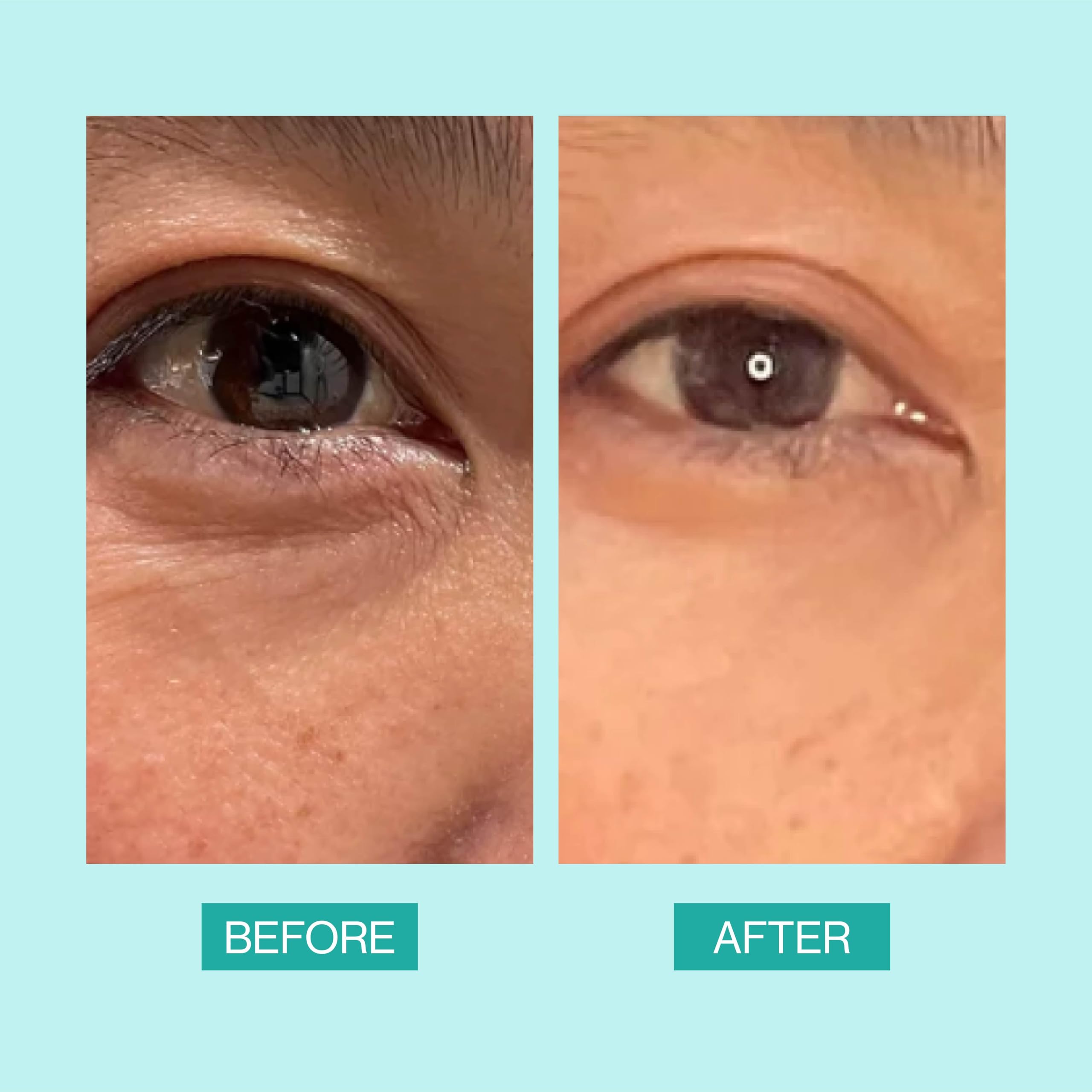 eb5 Daily Repair Eye Treatment vitamin e glow, nourishing and protective