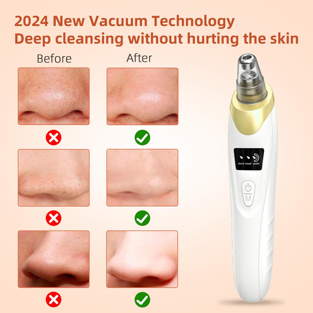 Echtur 2025 Pore Vacuum side profile highlights portable, easy grip design.