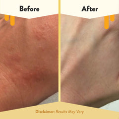 ECZEMA HONEY oatmeal body lotion label – gentle, fragrance-free care for sensitive skin