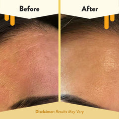 Travel-size ECZEMA HONEY cleanser for on-the-go sensitive skin care