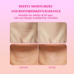 edemi neck-wrinkle-patches overnight-use worn to smooth neck lines