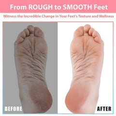 Efforest pumice stone removes dead skin and calluses for smoother heels.