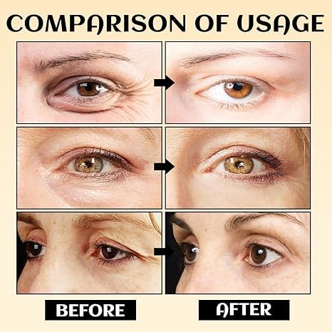 EHAUTO travel size turmeric eyes cream ideal for on the go hydration