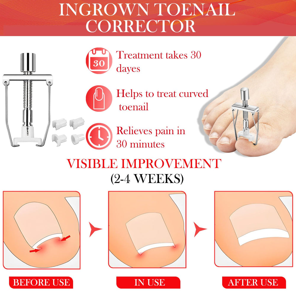 ELALRAU toenail correct patch illustration shows discreet, on-the-go support for daily wear