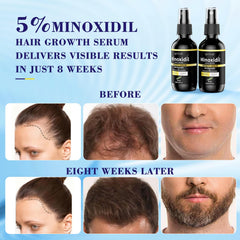 Elegra daily morning routine with minoxidil spray