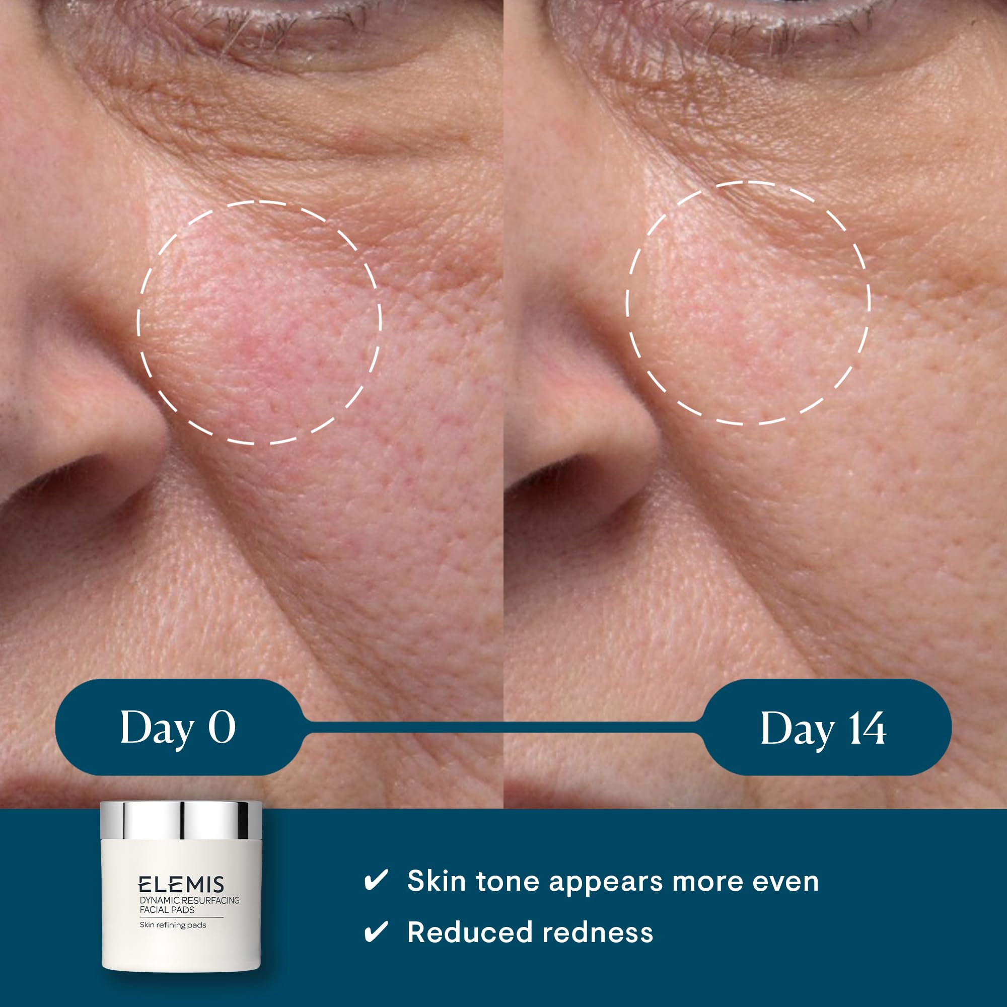 ELEMIS Dynamic Resurfacing Facial Pad smooth side for clearing dislodged skin after cleansing.