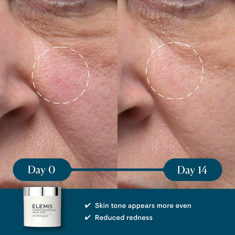 ELEMIS Dynamic Resurfacing Facial Pad smooth side for clearing dislodged skin after cleansing.