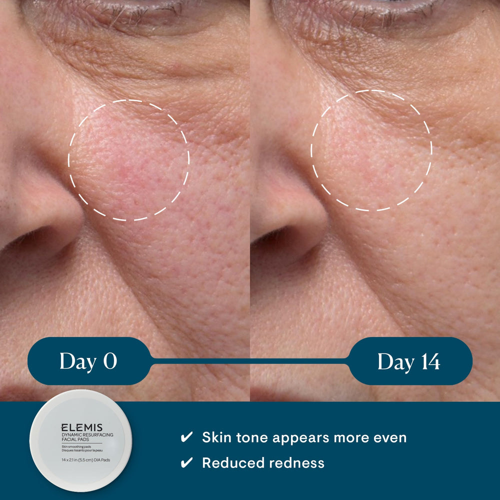 elemis dynamic resurfacing pads textured-side close-up illustrating deeper exfoliation for smoother skin