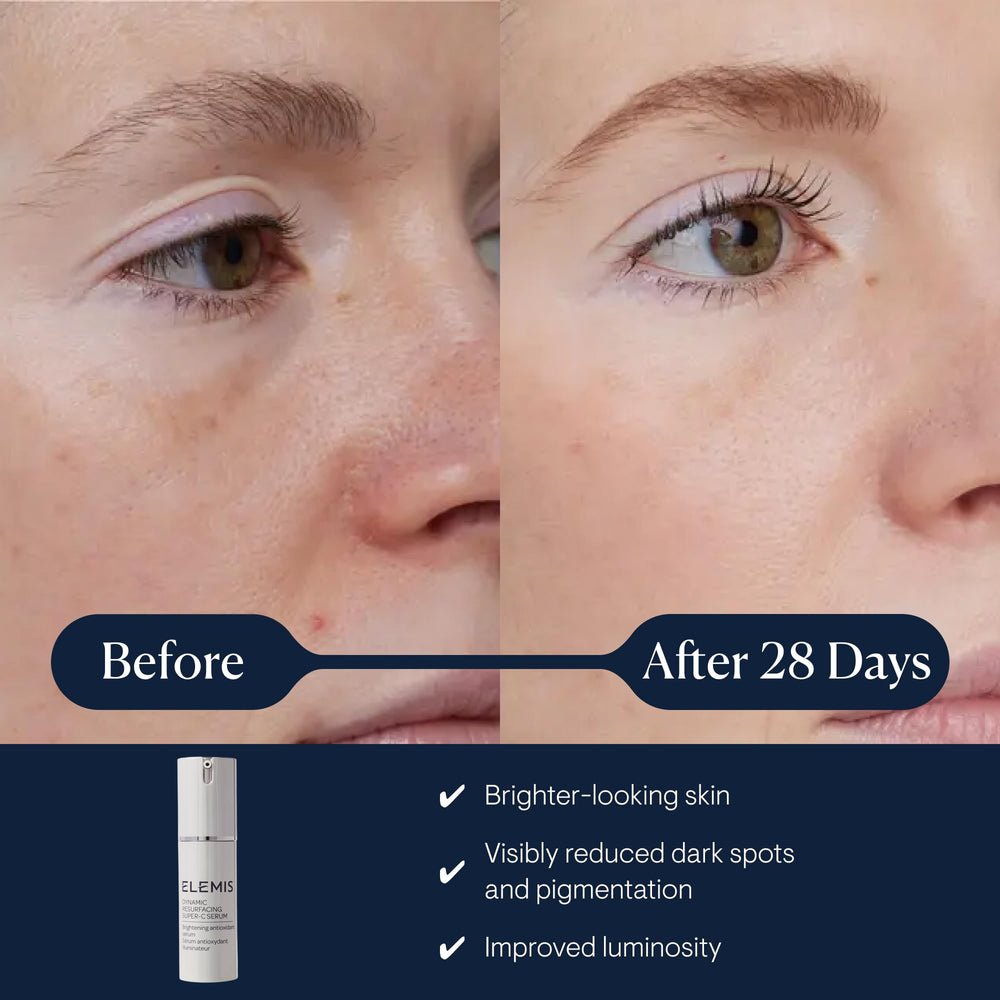 ELEMIS Dynamic Resurfacing Serum pump for easy, even application