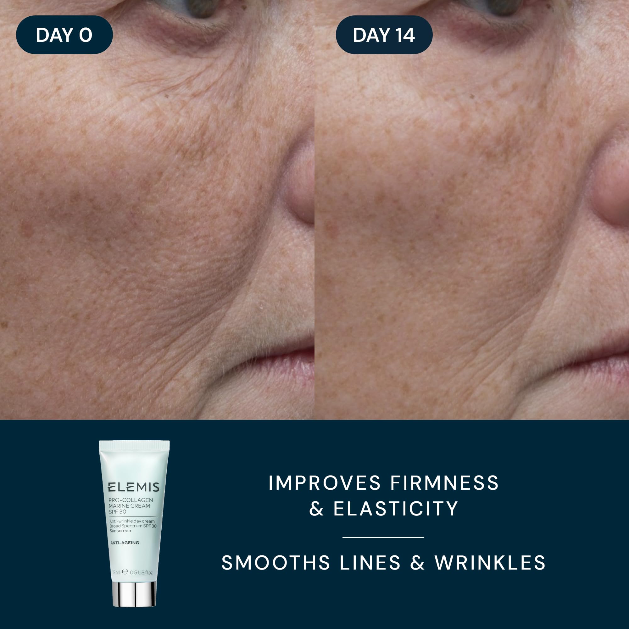 Elemis travel-ready kit staged for on-the-go skincare routines.