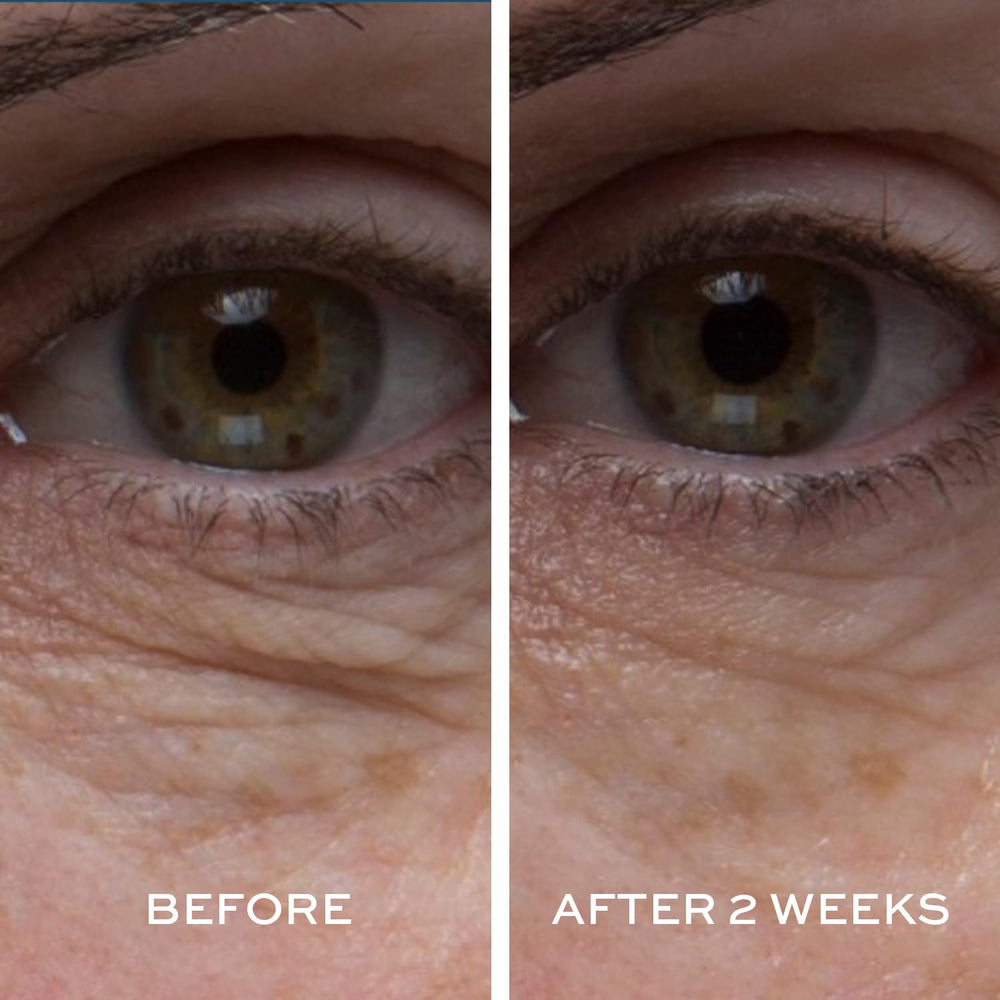 Elemis Peptide4 Eye Recovery Cream application on finger shows smooth absorption