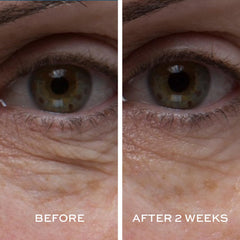 Elemis Peptide4 Eye Recovery Cream application on finger shows smooth absorption