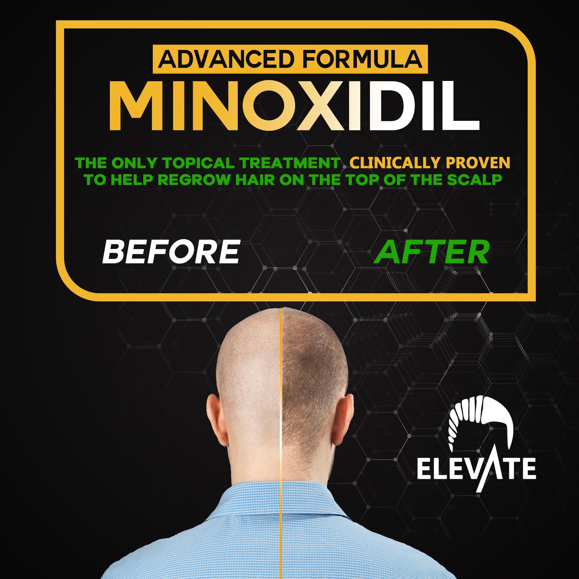 Elevate fast absorbing spray applied to dry hair before styling