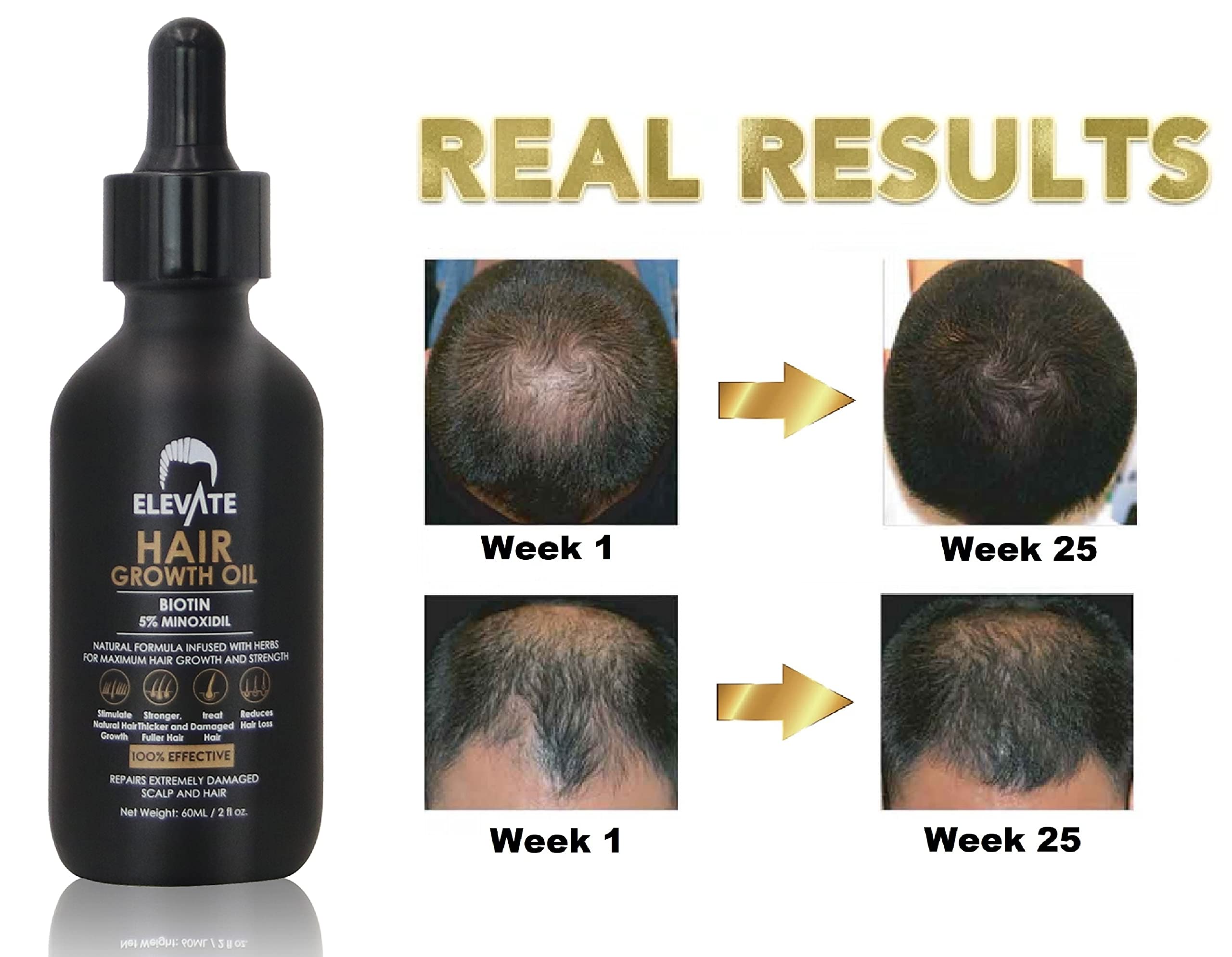 Elevate Hair Regrowth Serum texture highlights lightweight non-greasy feel