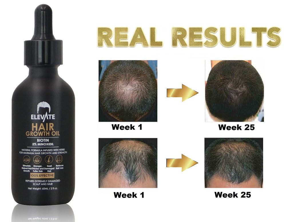 Elevate Hair Regrowth Serum texture highlights lightweight non-greasy feel