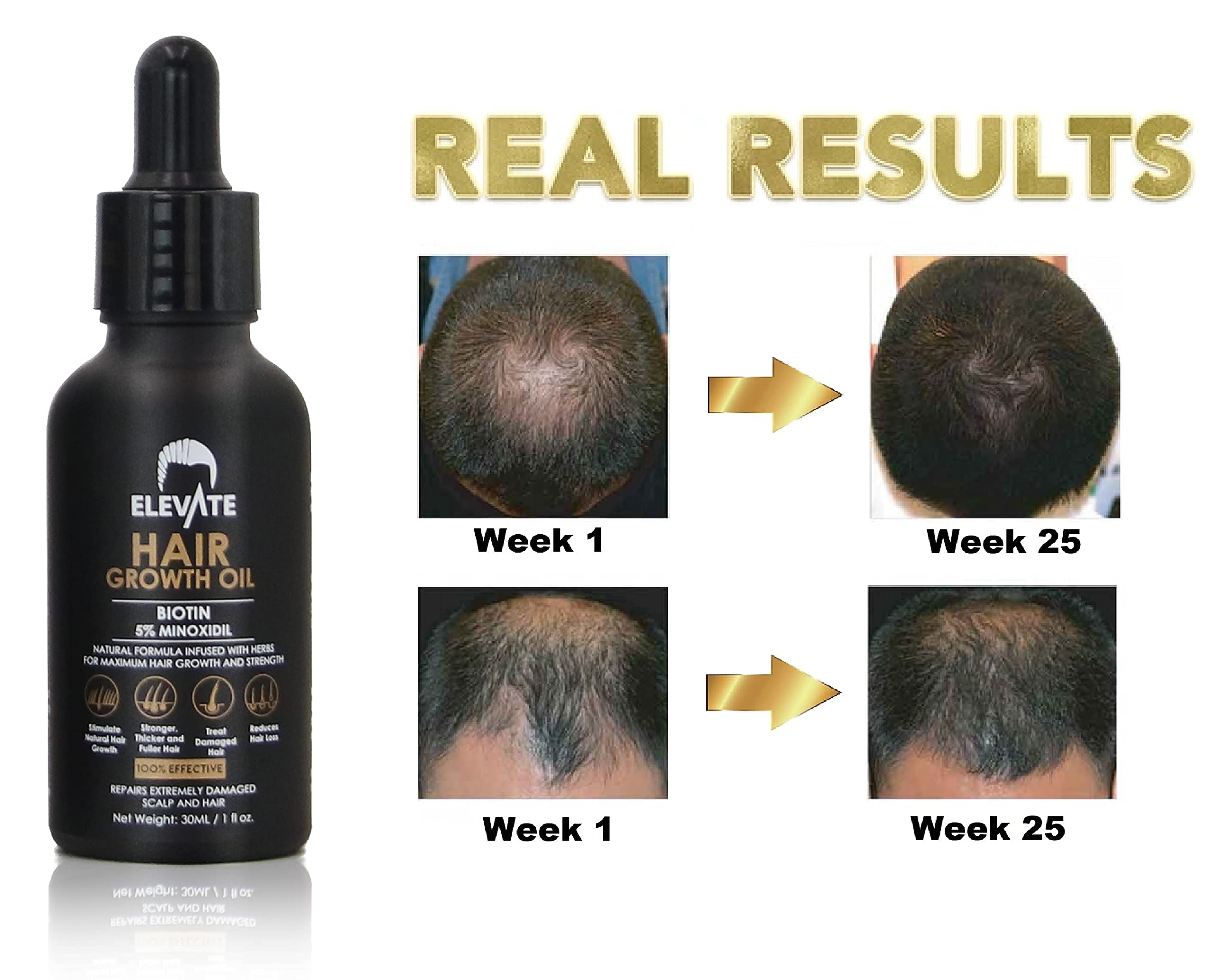 Elevate Hair Regrowth Treatment showcasing its natural ingredients with benefits.