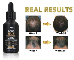 Elevate Hair Regrowth Treatment showcasing its natural ingredients with benefits.