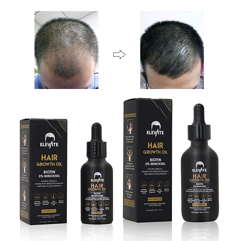Elevate Hair Regrowth Treatment focusing on the blend of natural ingredients.