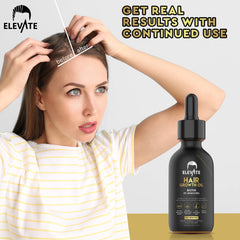 Elevate Hair Regrowth Treatment applied on damp hair for improved results.
