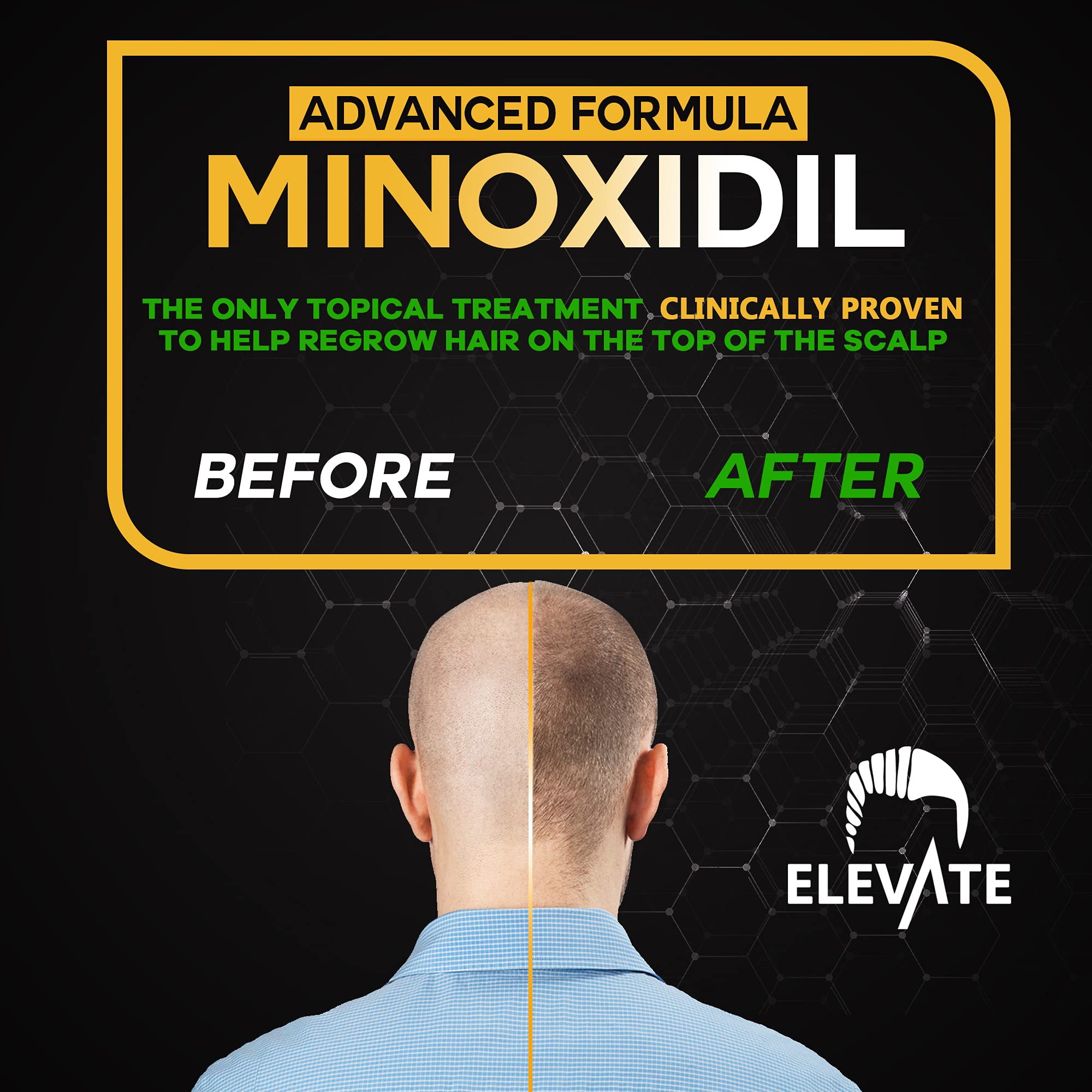 Elevate herbal blend bottle label highlighting Biotin and Coconut Oil for scalp nourishment.