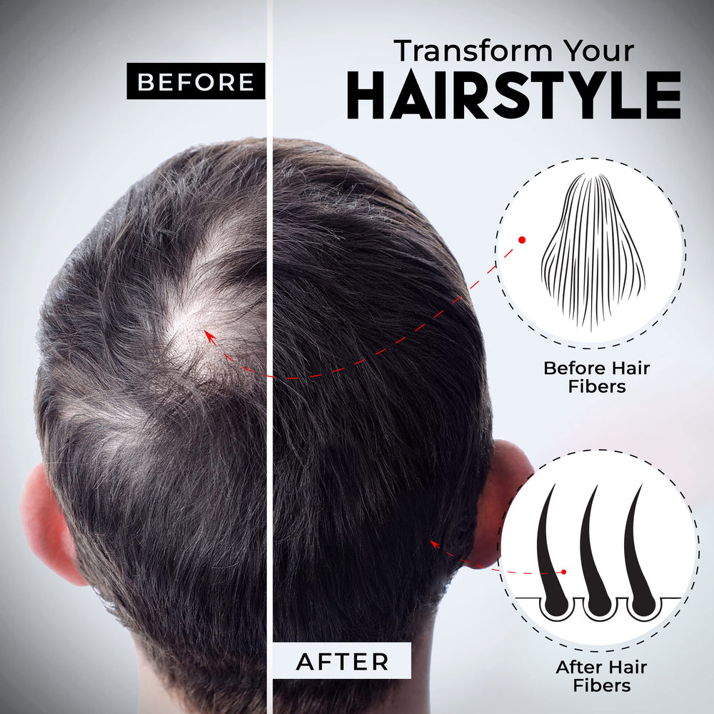Elevate Patchy beard edges filled with salon-quality accuracy