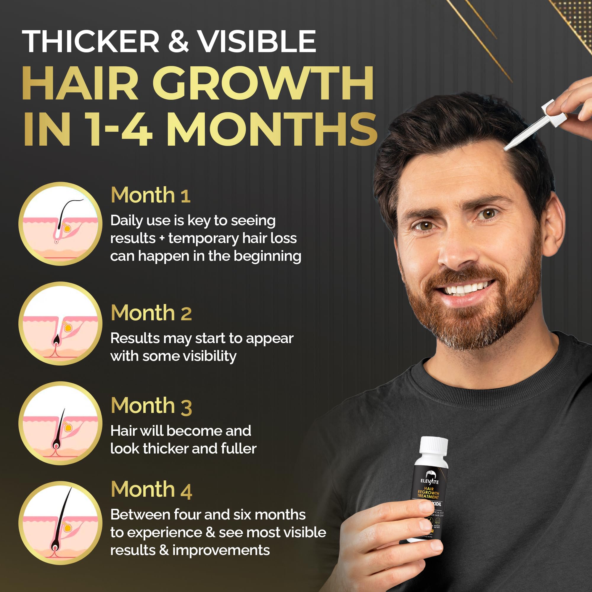 Elevate shedding-reduction visual showing improved scalp fullness over time.