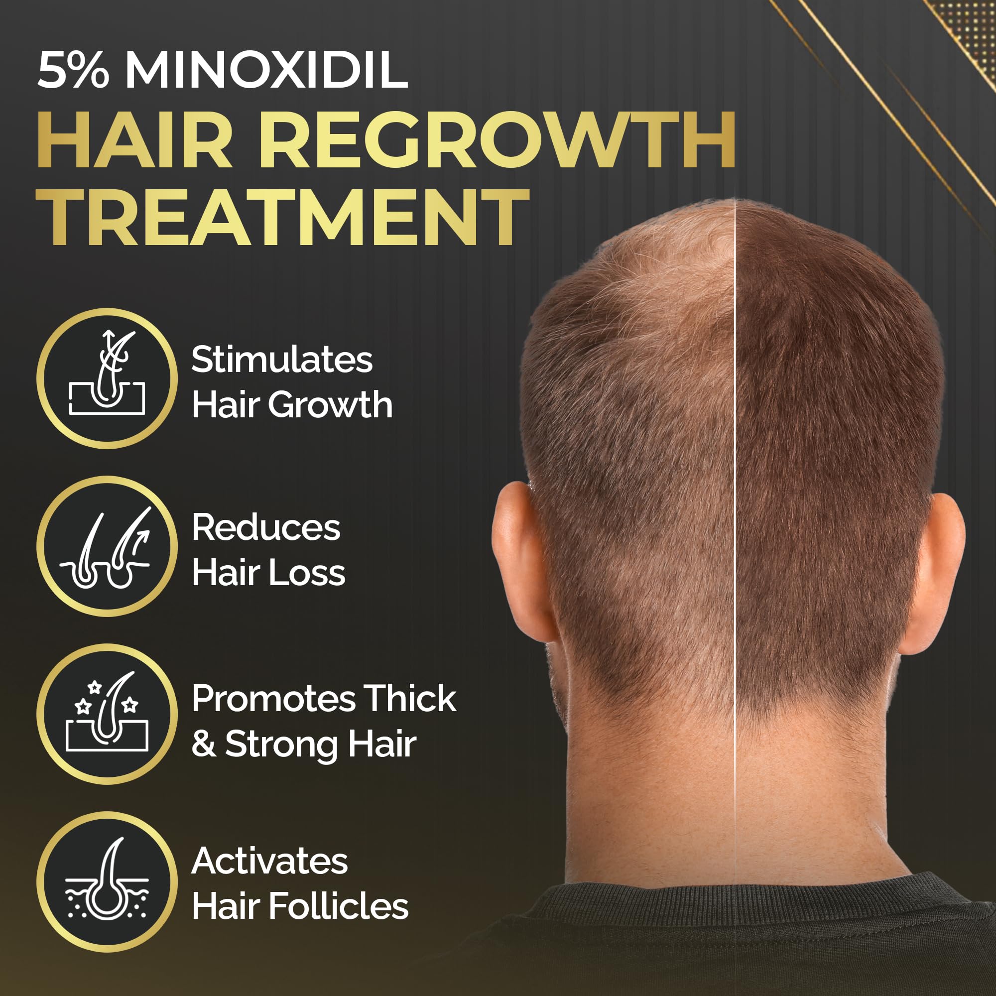Elevate thicker fuller hair close-up demonstrates denser strands with consistent use.