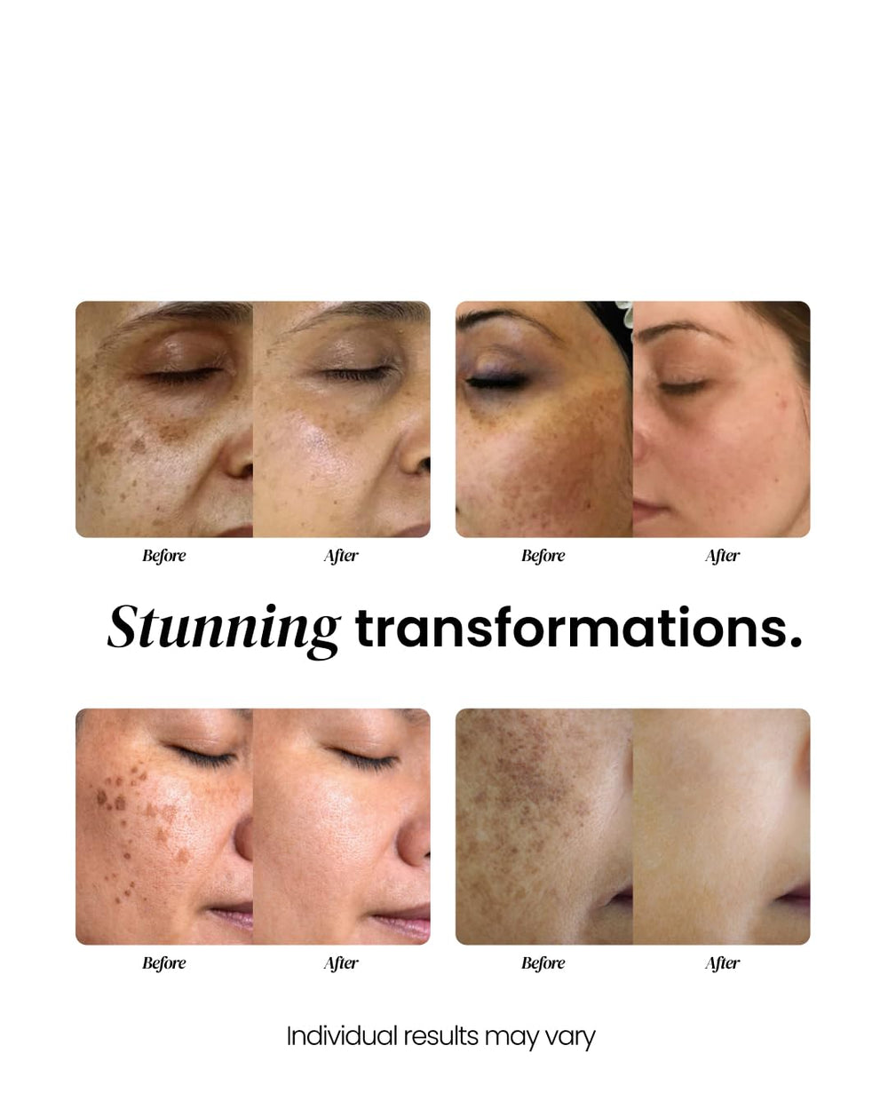 Eliré Radiance & Renewal Serum Kojic Acid ingredient highlighted for brightening potential